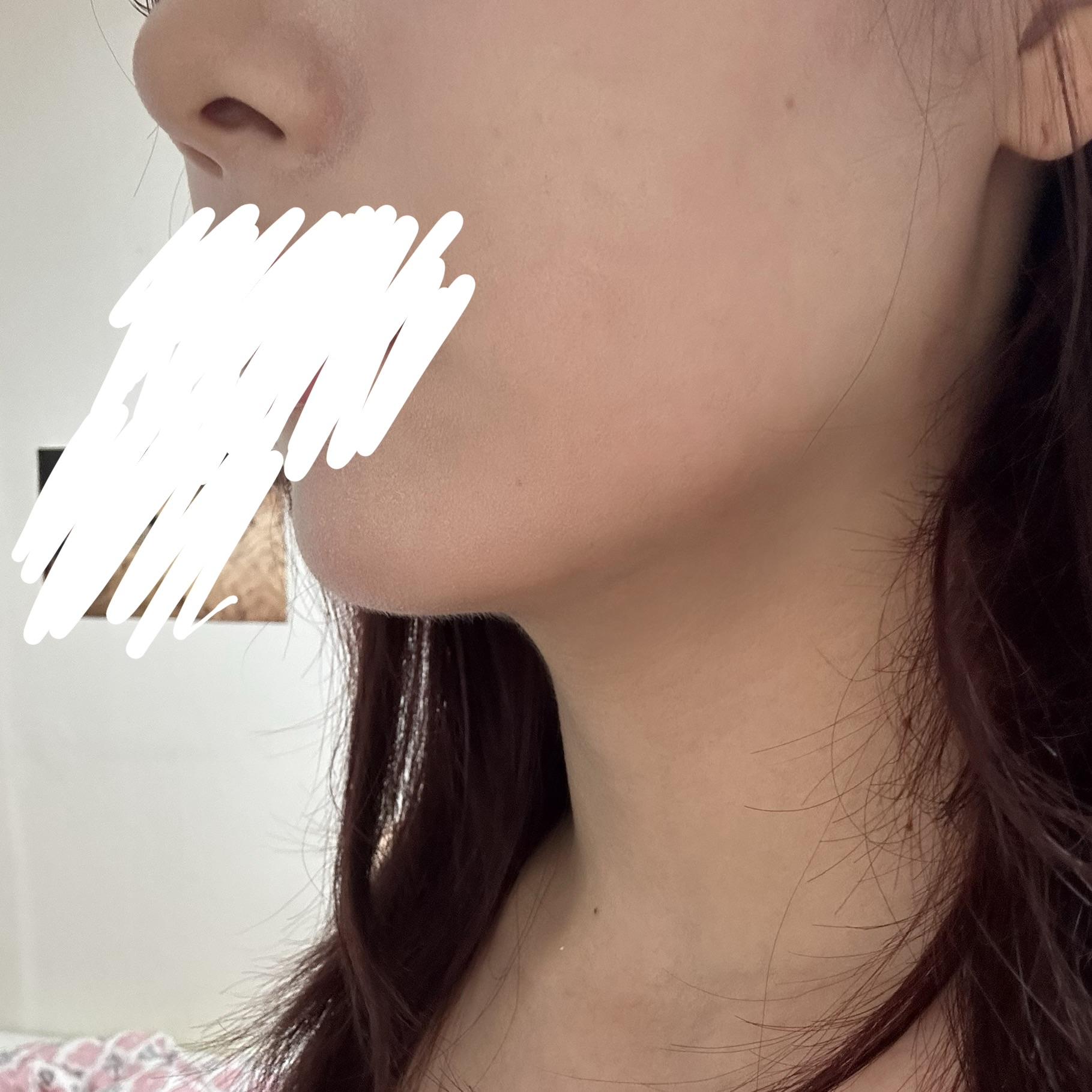 後