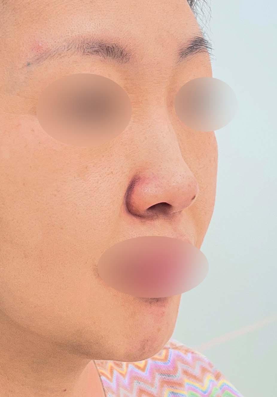 後