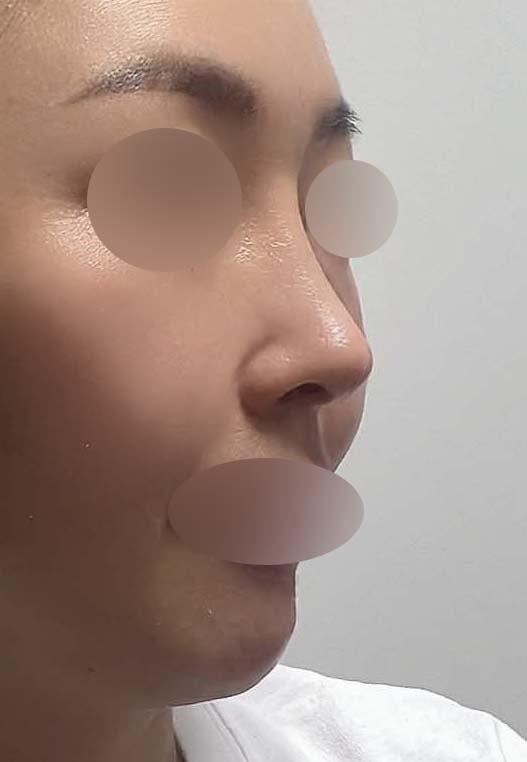 後
