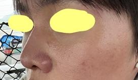 後