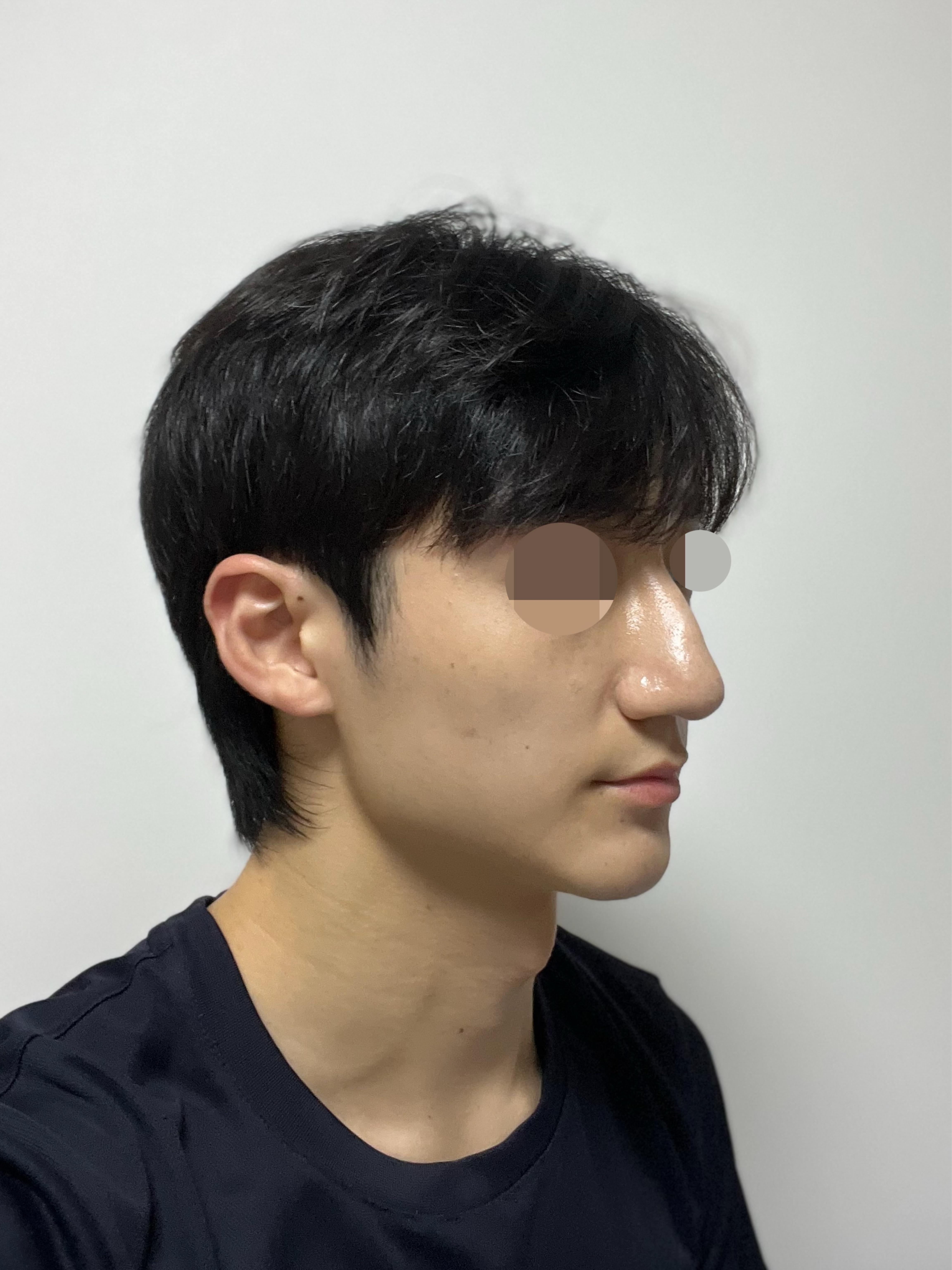 後