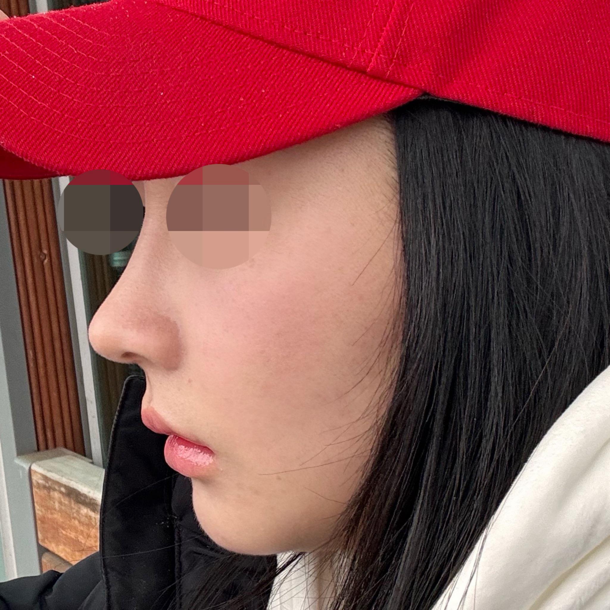後