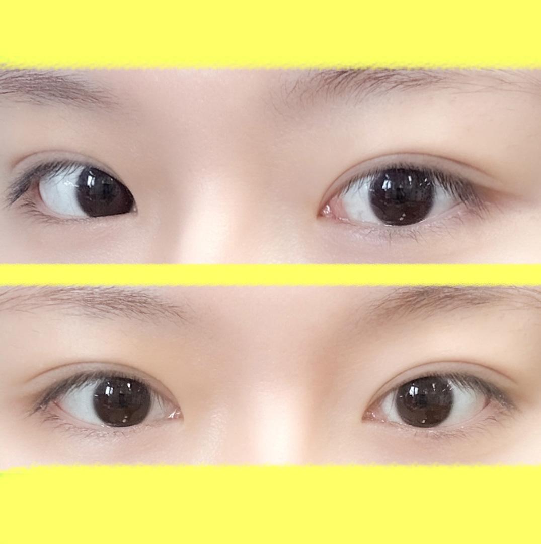 後