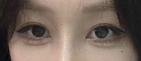 後