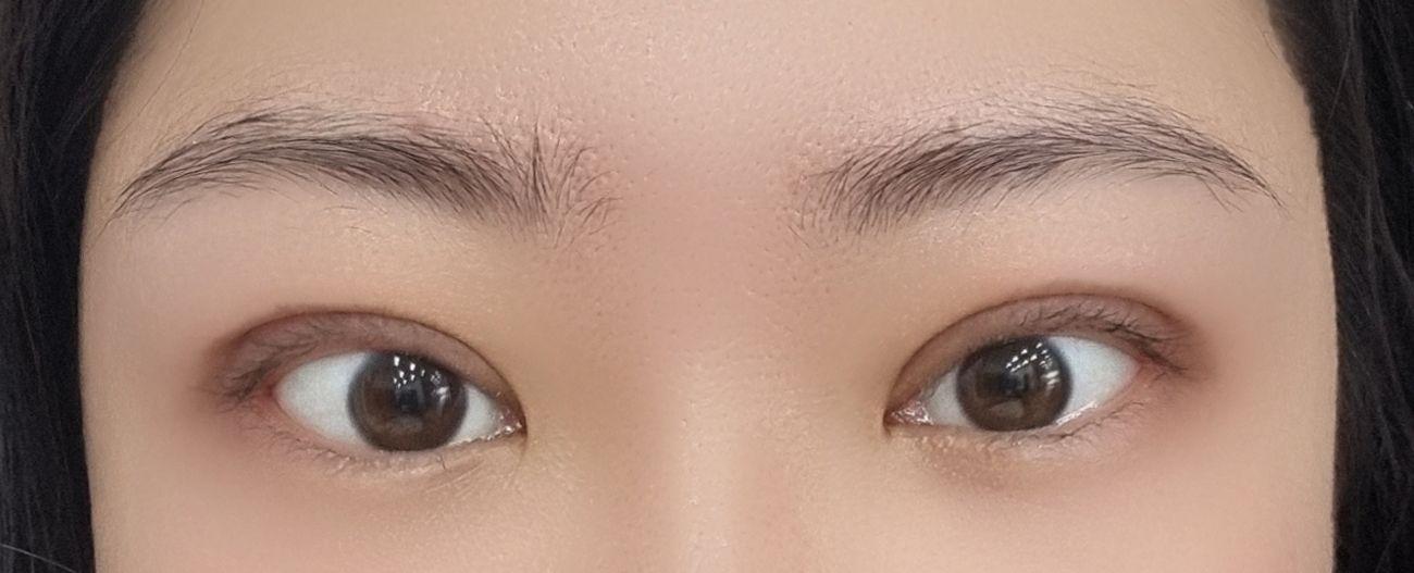 後