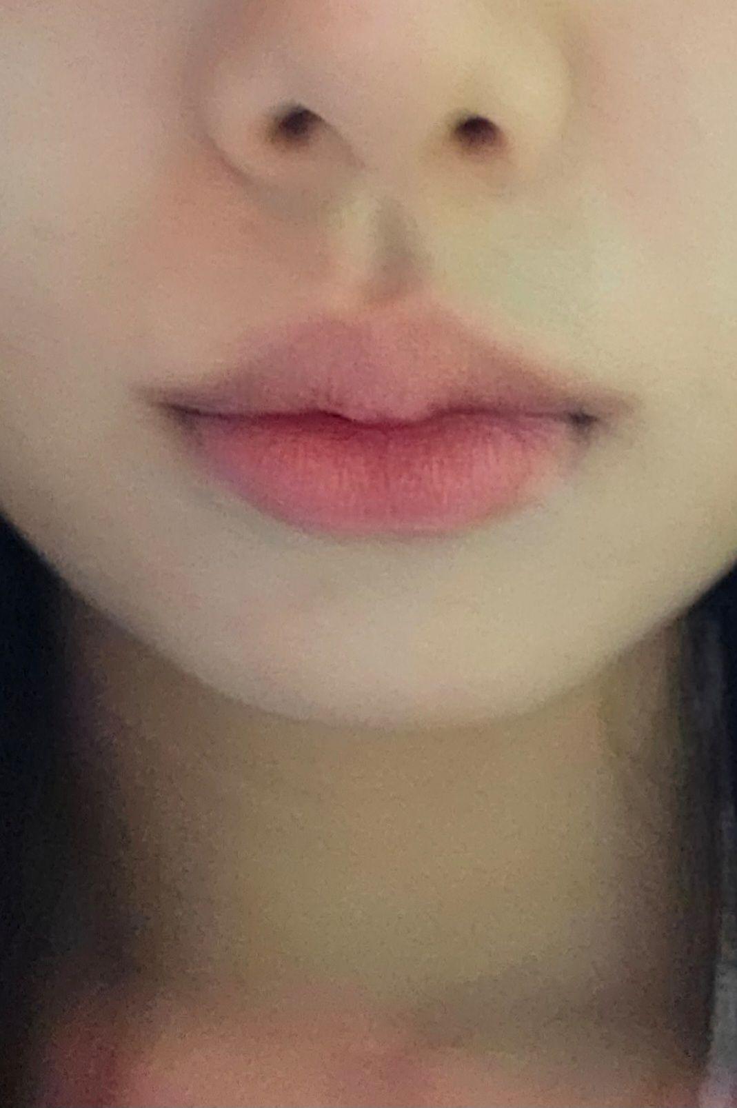 前