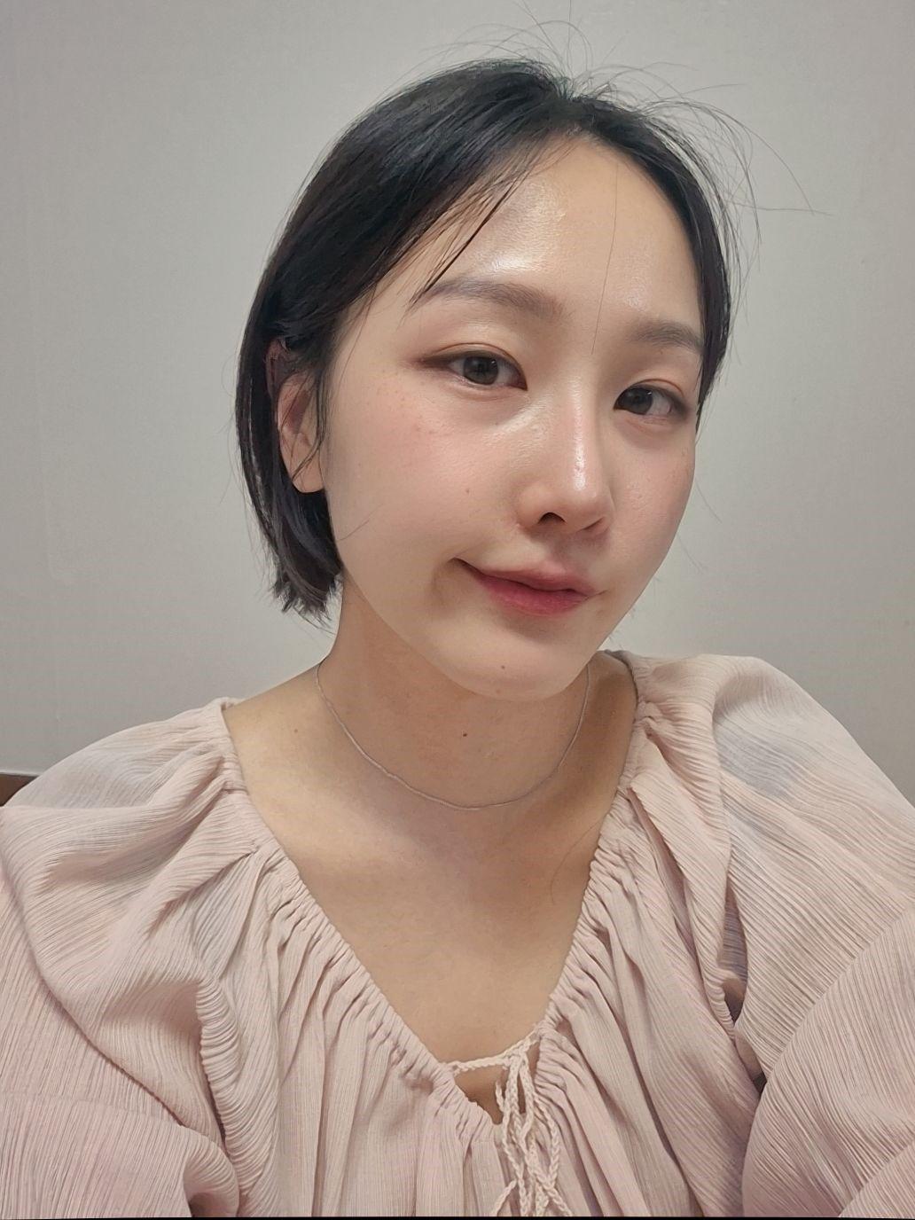 後