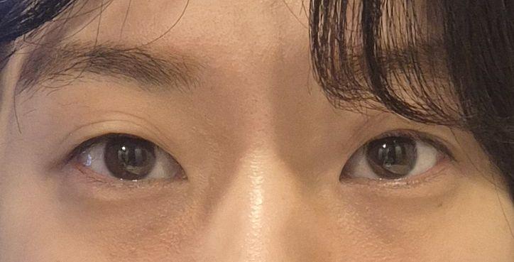 後