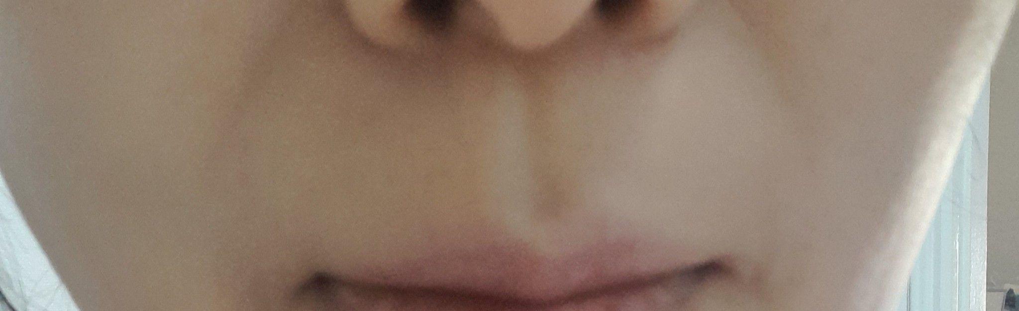 後