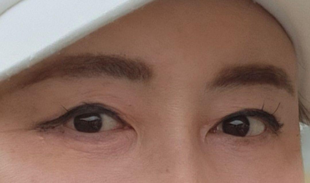 後