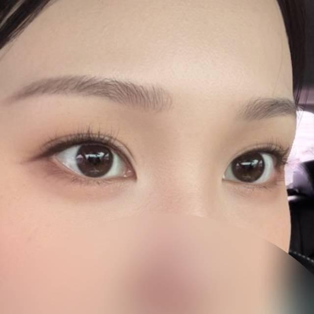 後