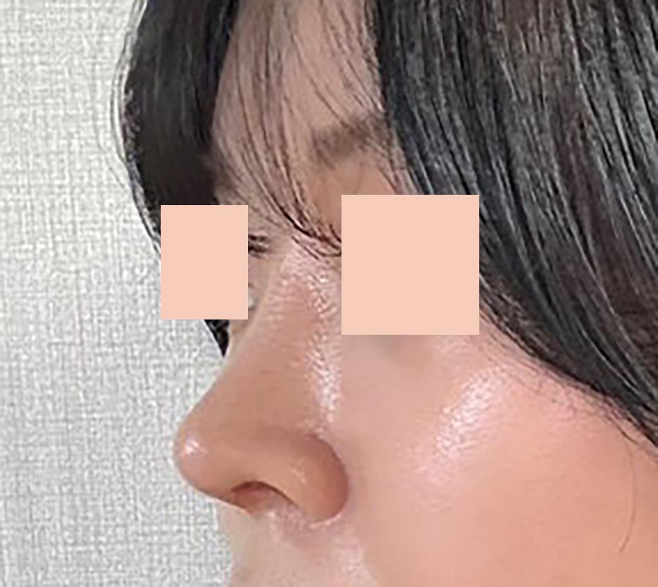 後