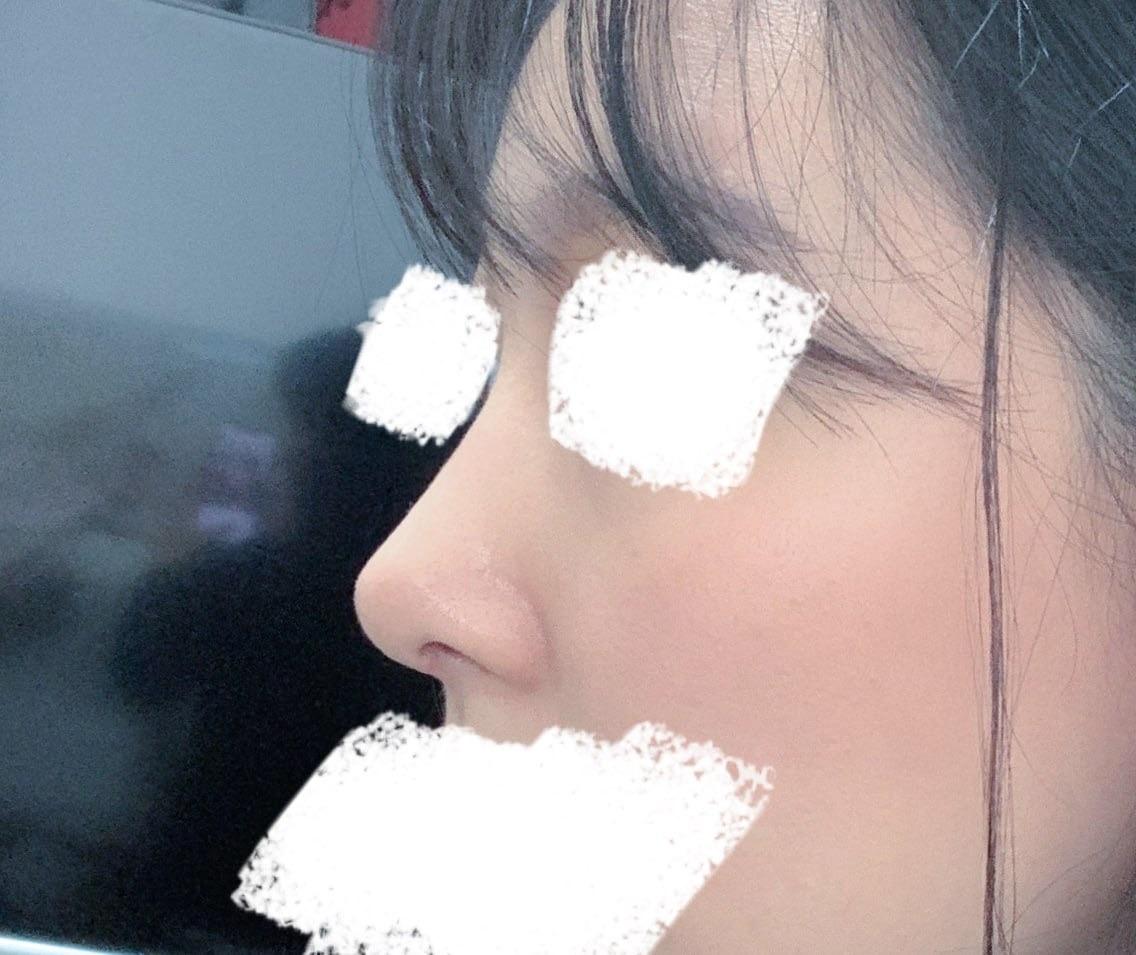 后