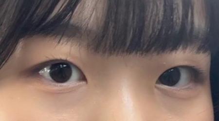 後
