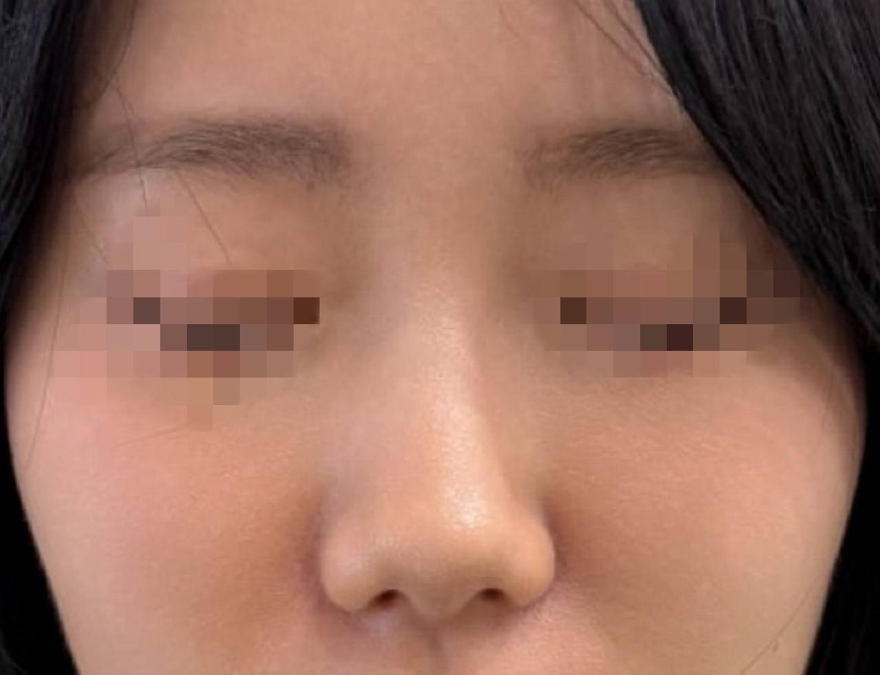 後