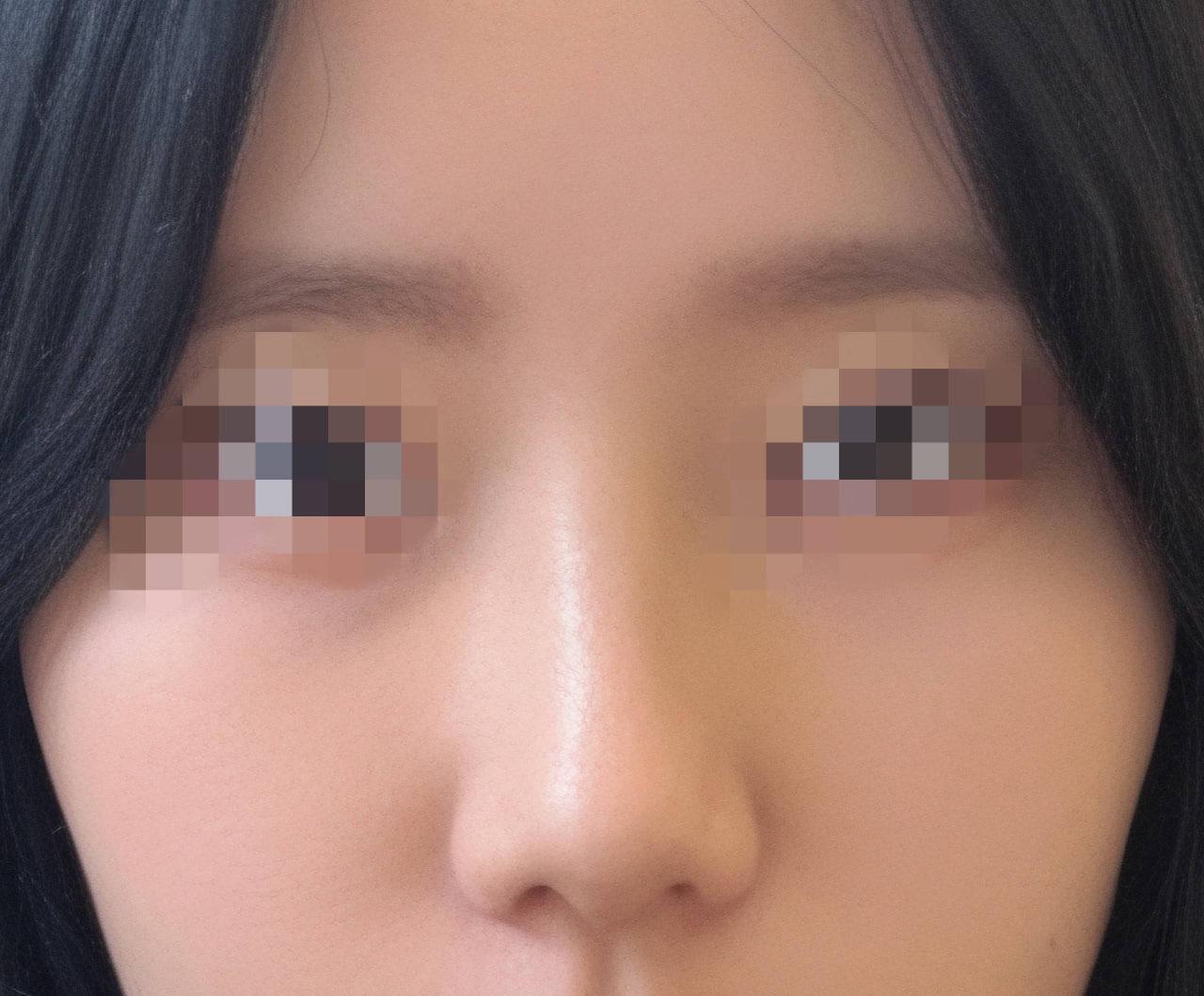 後