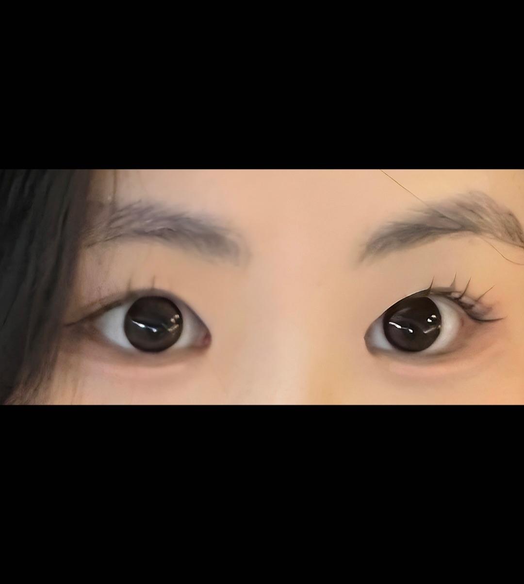 後