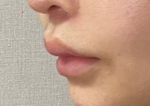 後