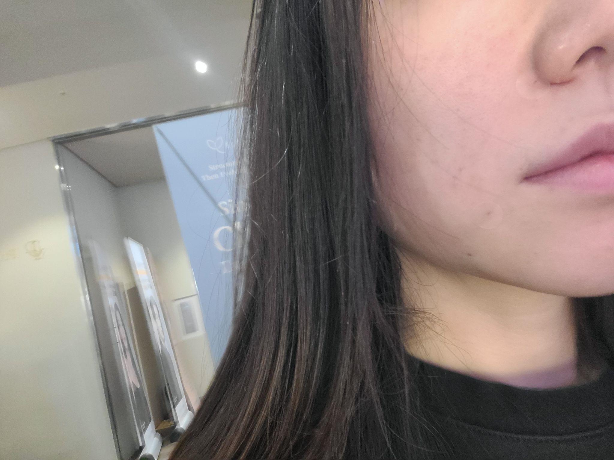 後