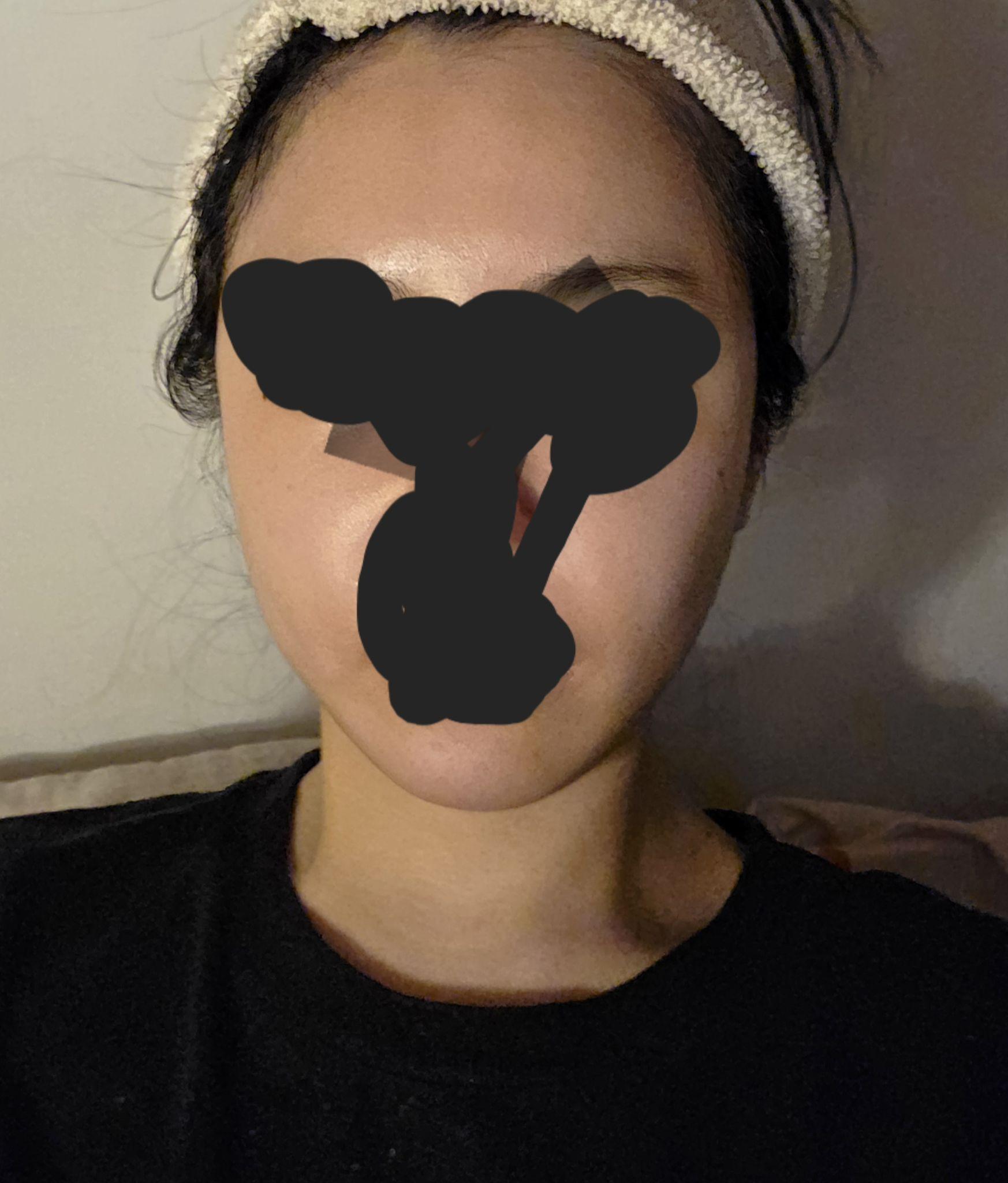 後