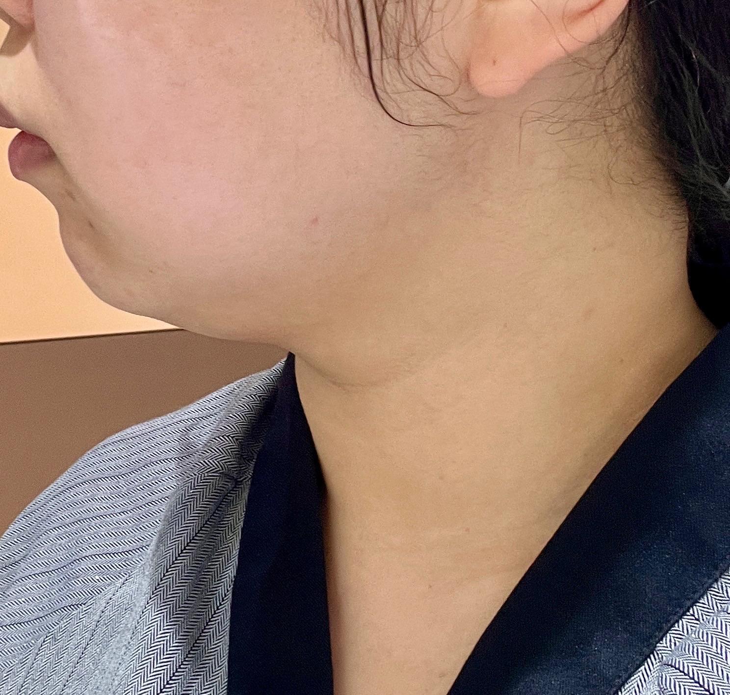 後