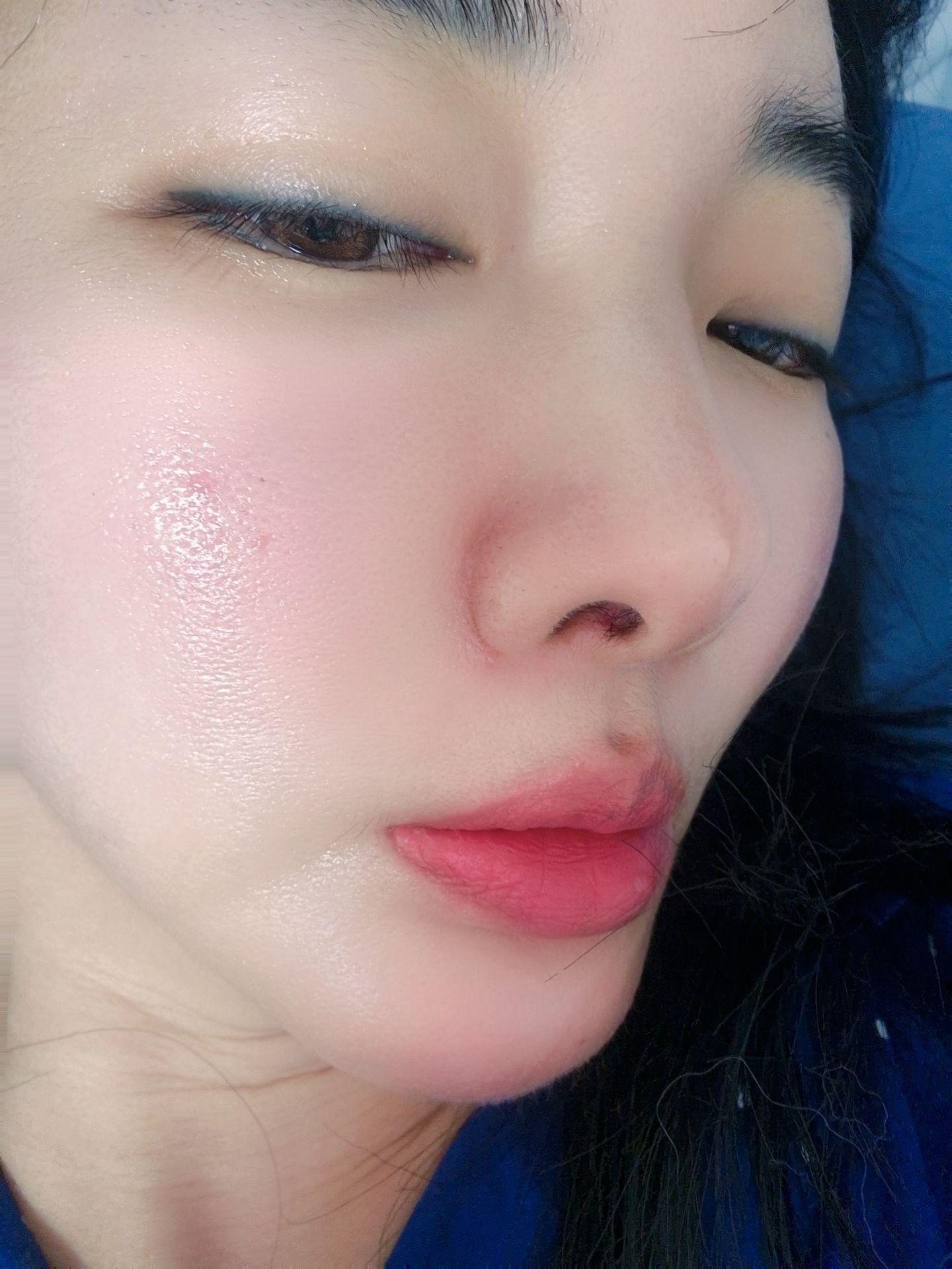 後