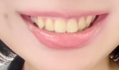 後