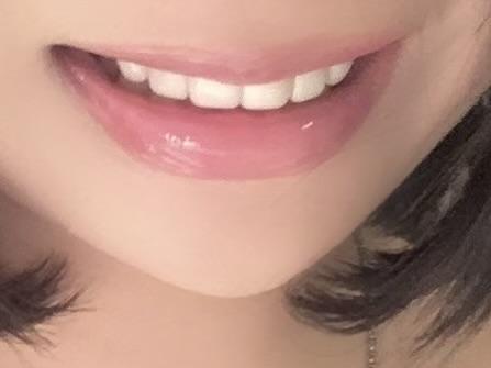 後