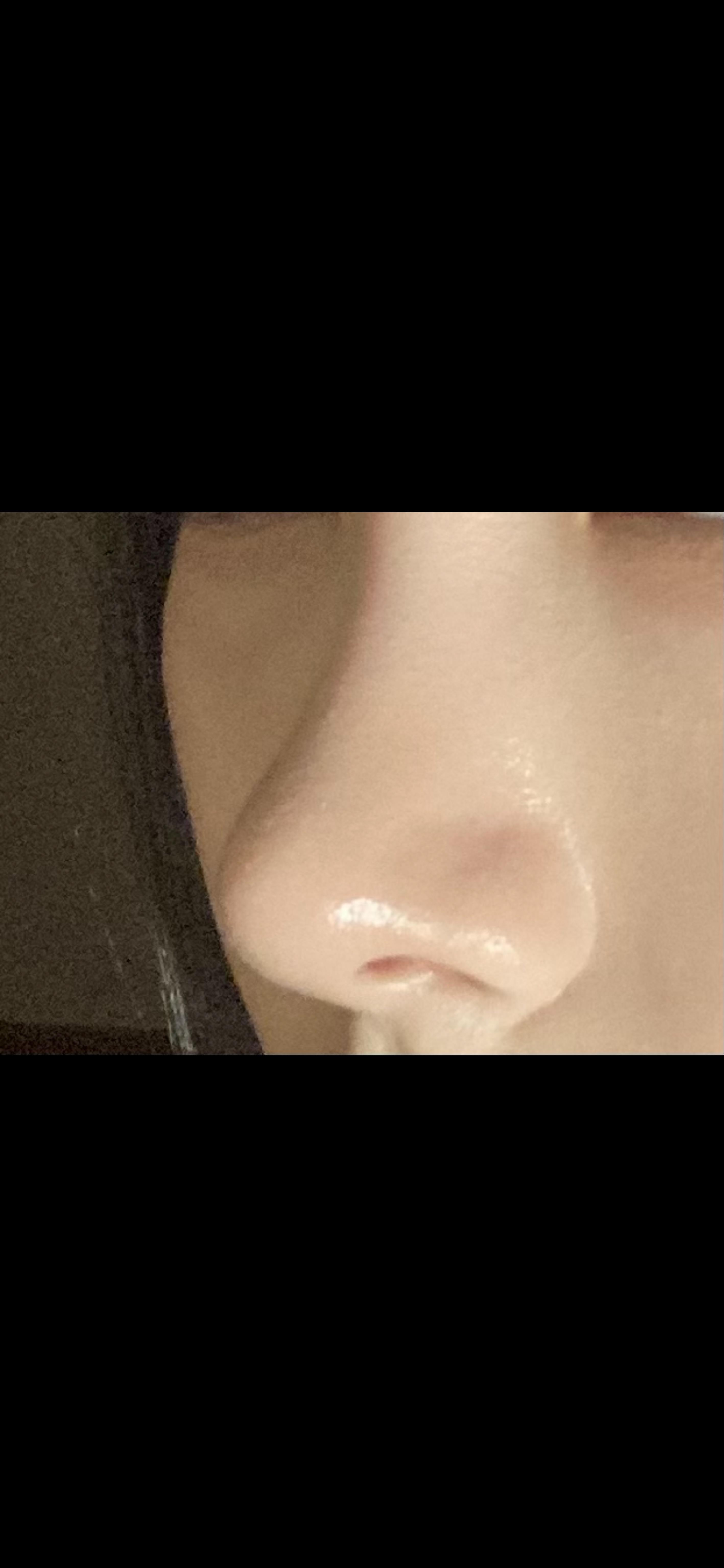 後