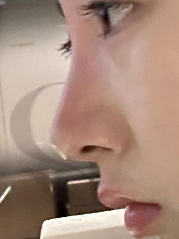 後