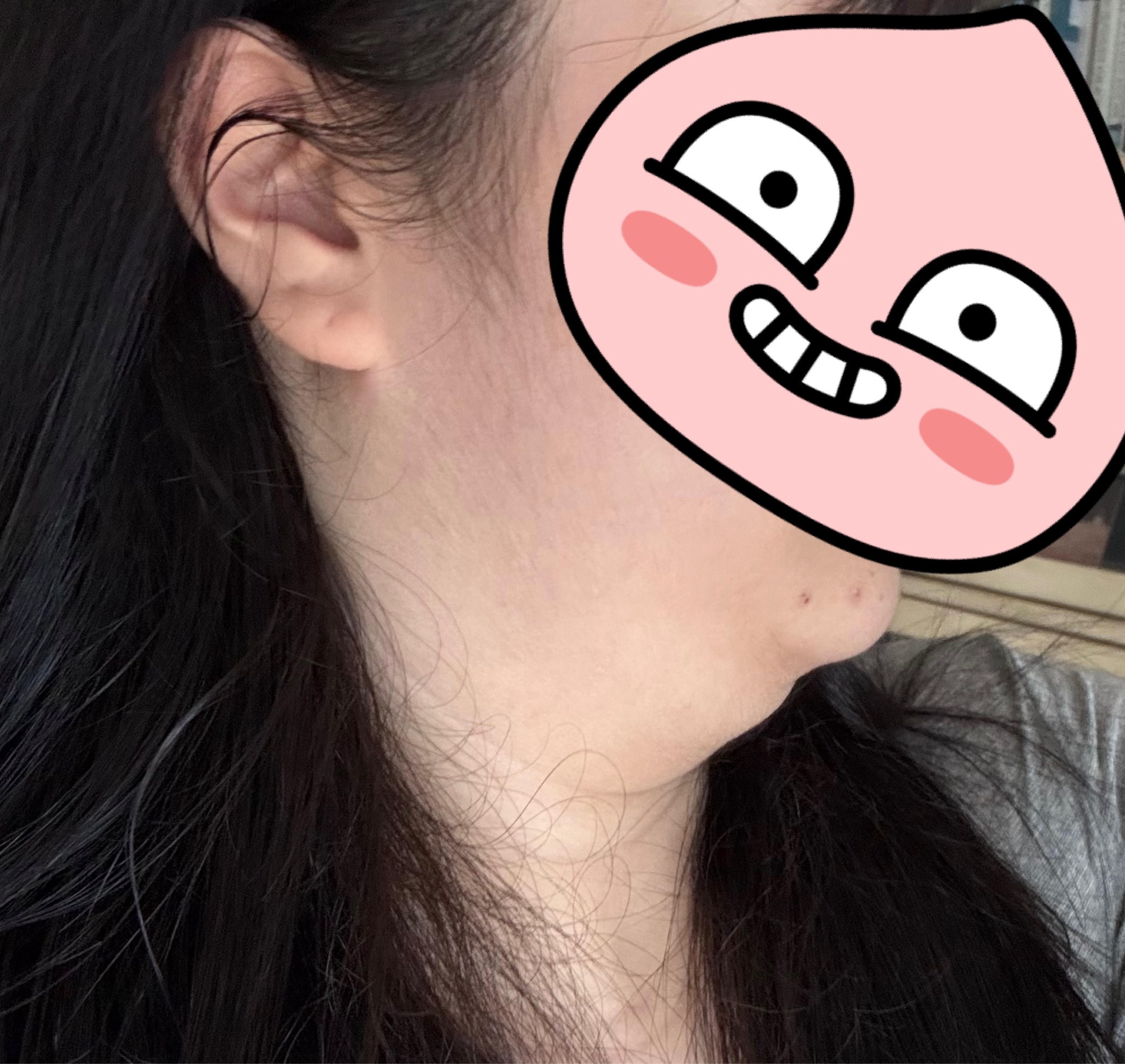 後