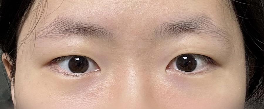後