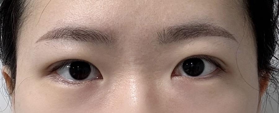 後