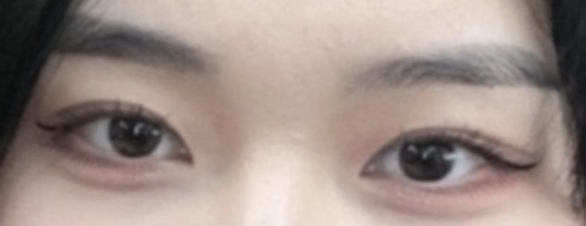 後