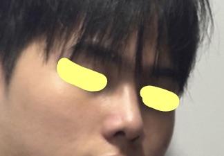 後