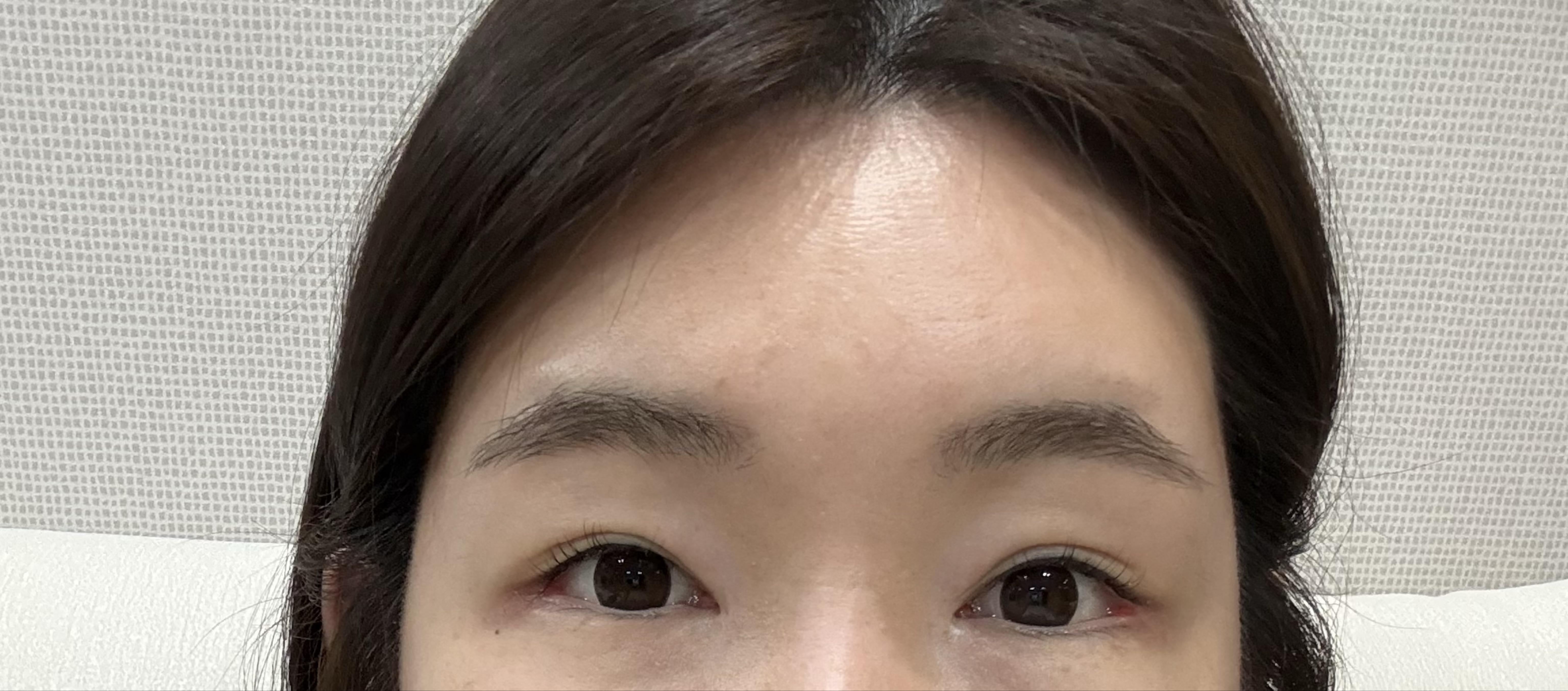 後