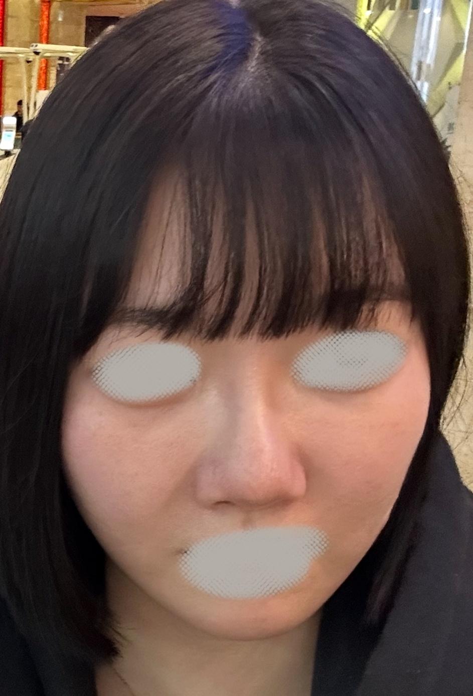 後