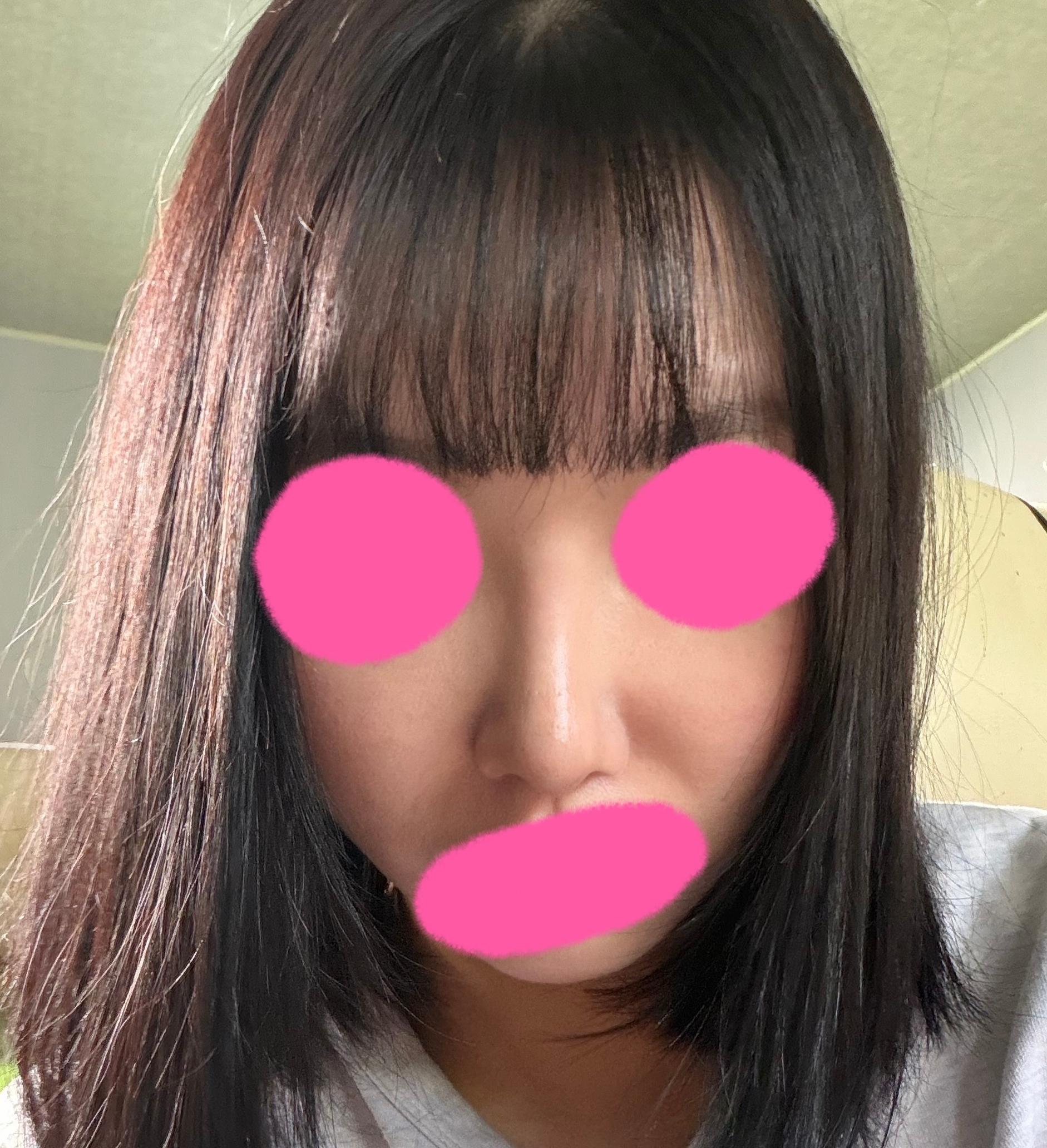 後