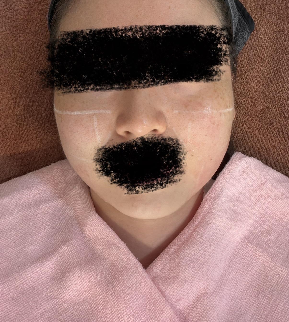 前