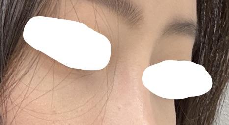 後