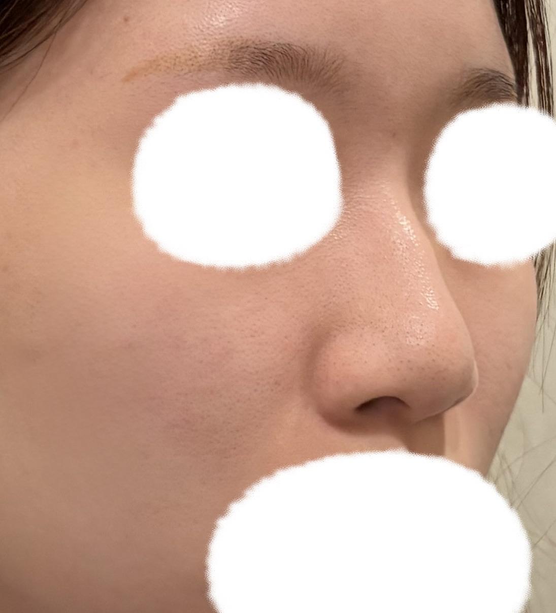 後