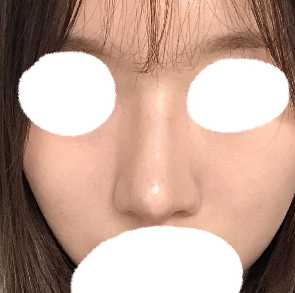 後