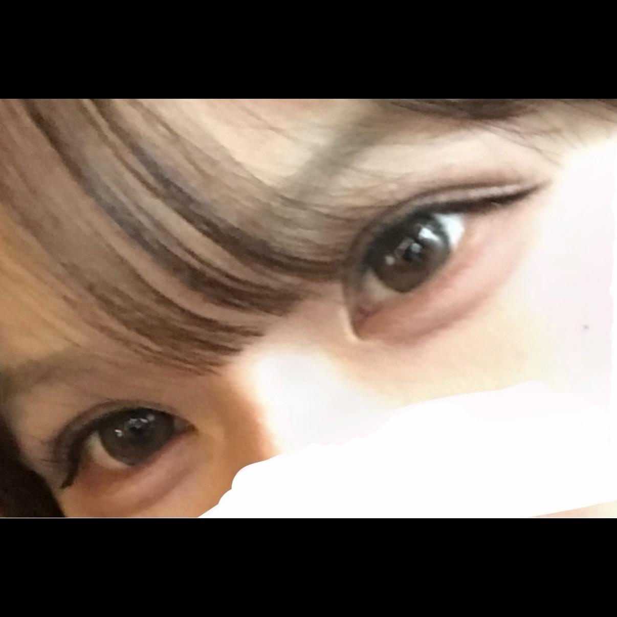 後