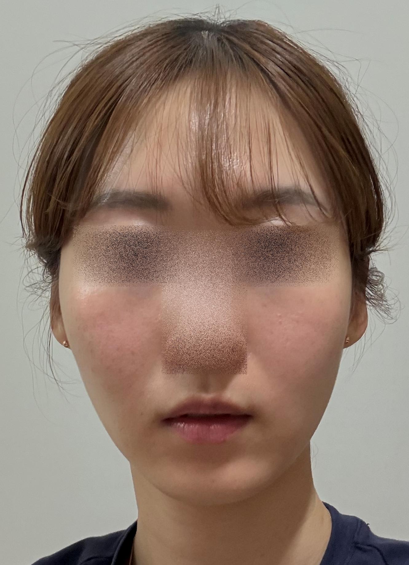 後