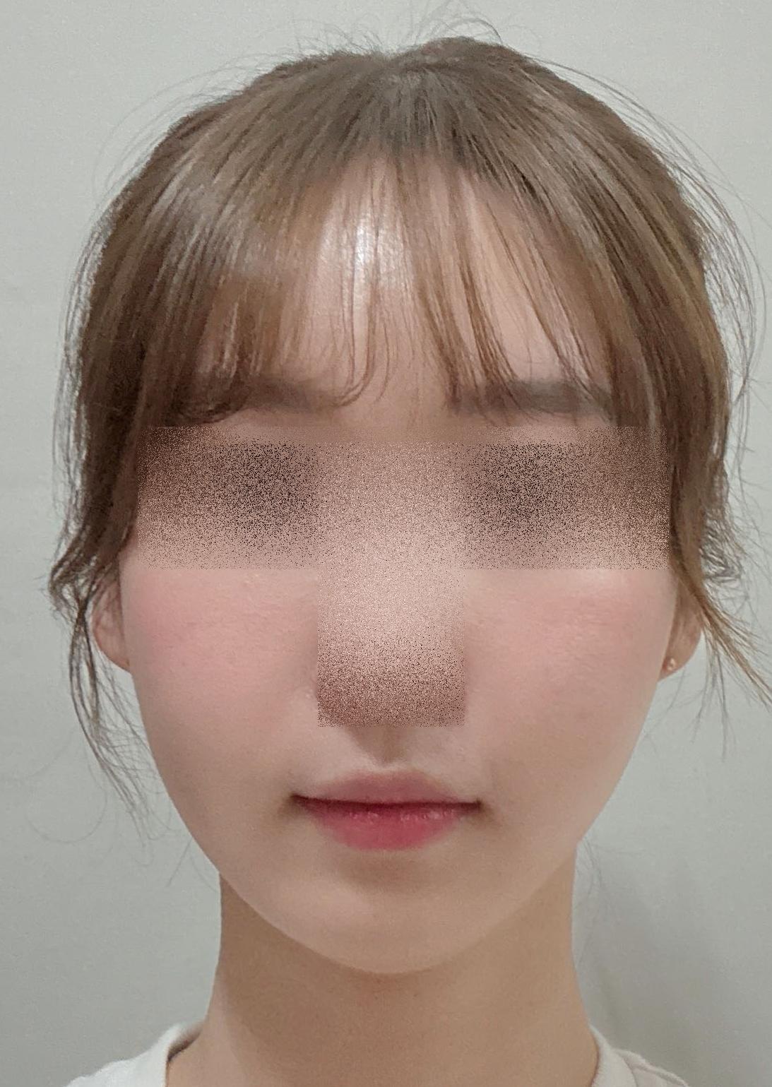 後