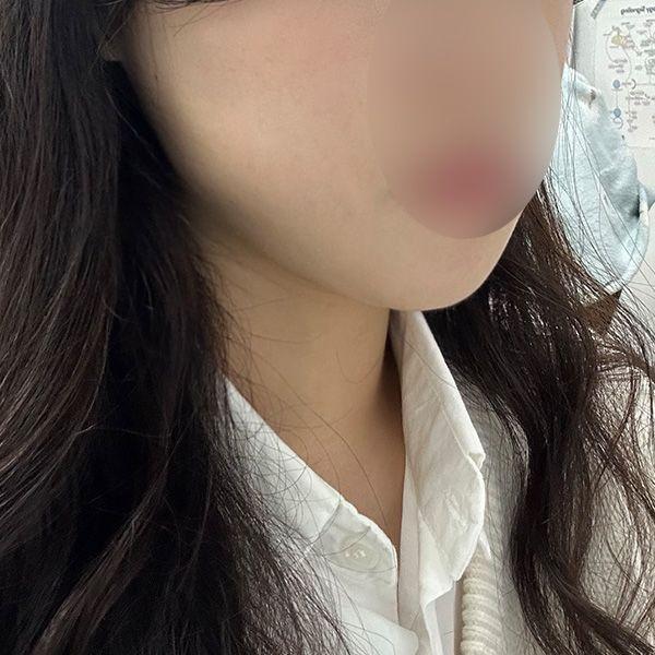 後