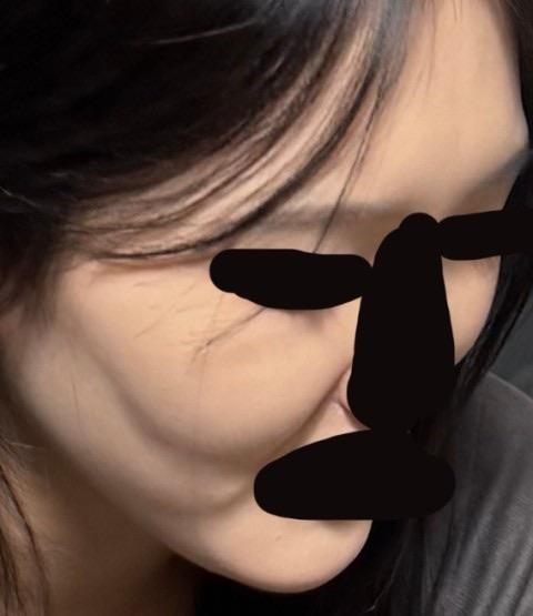 後