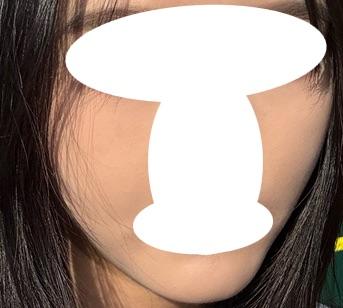 後