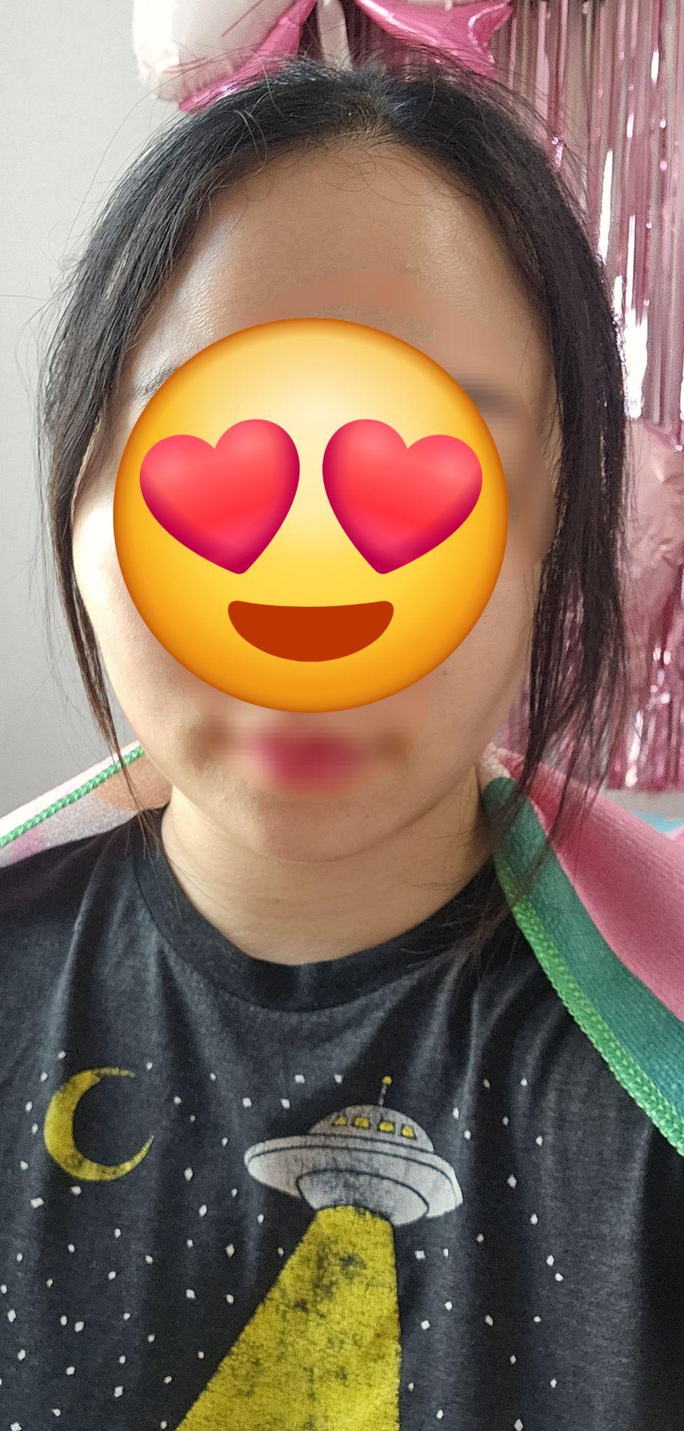 後