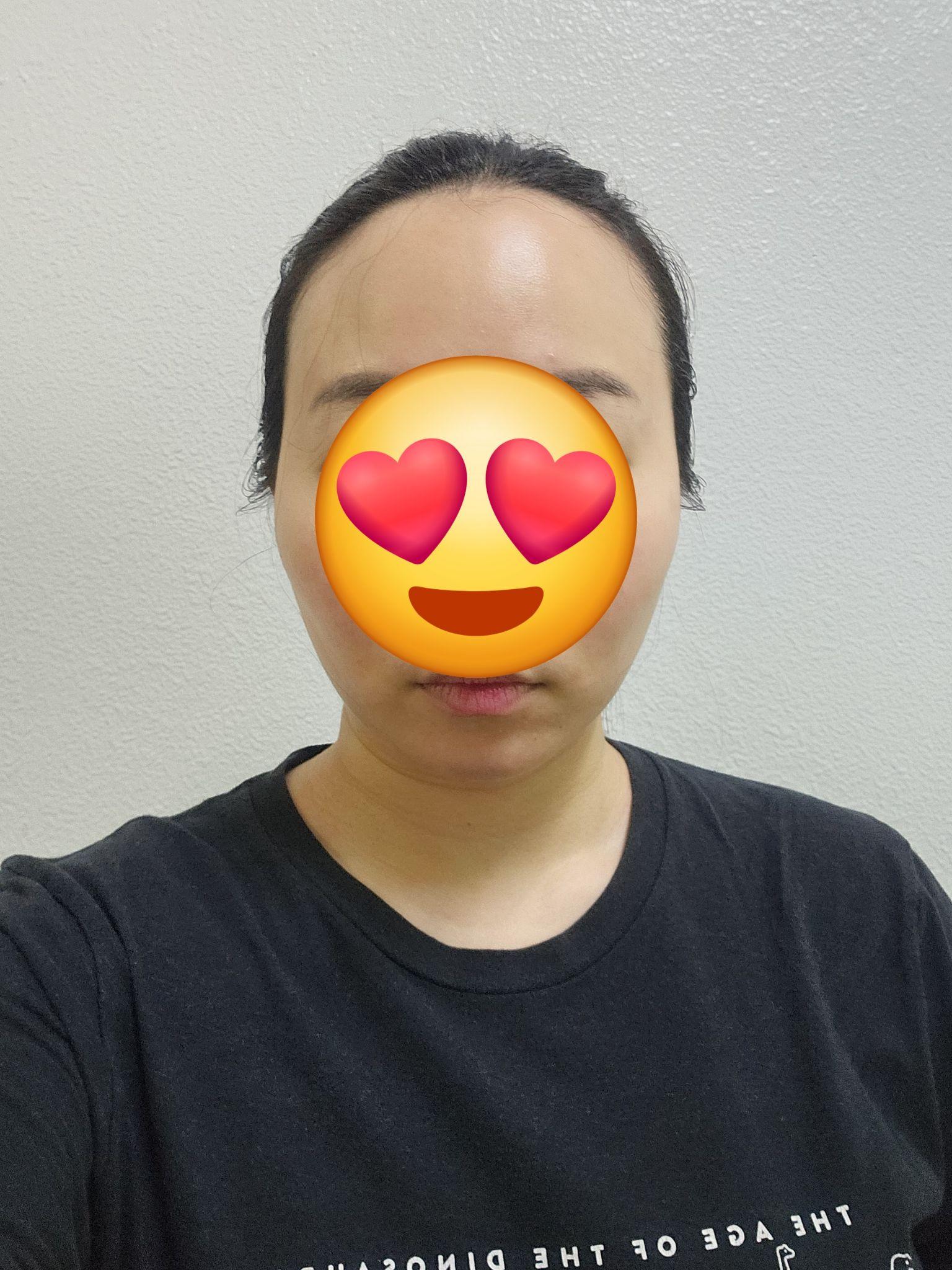 後